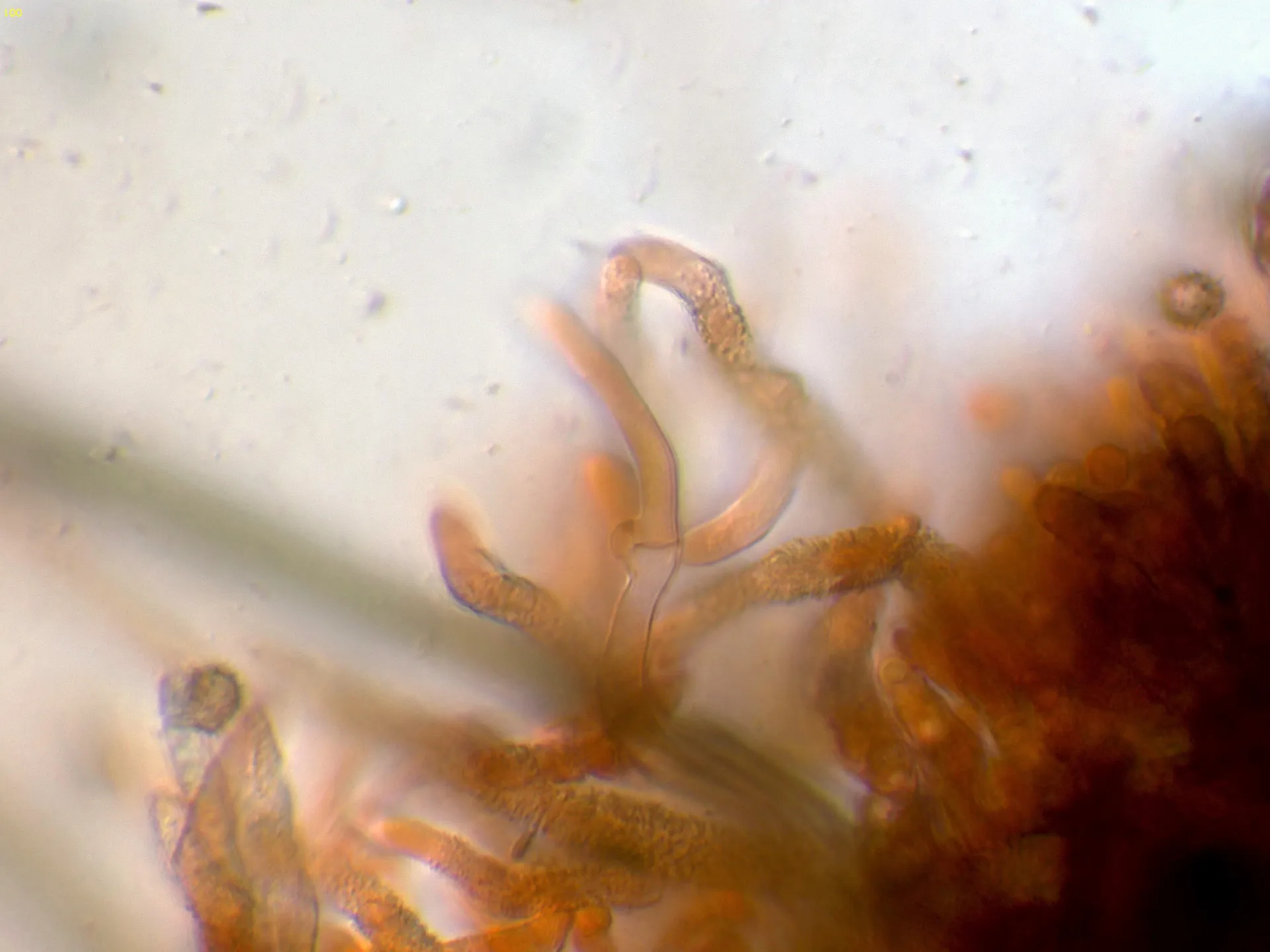 Microscopía de Tomentella lilacinogrisea - 10 - Himenio-001